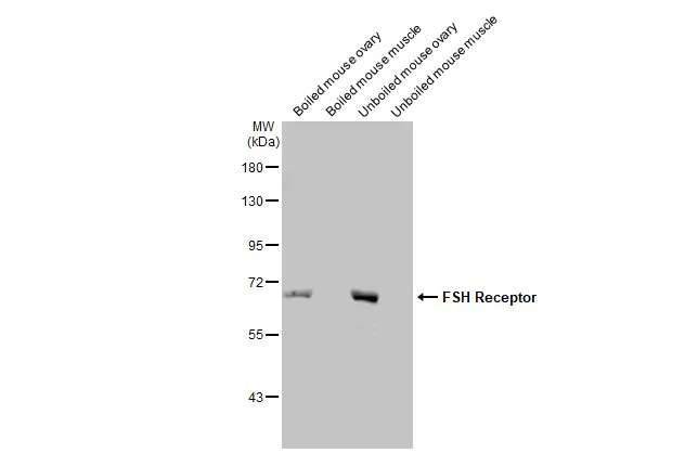 Boiled and unboiled various tissue extracts (50 μg) were separated by 7.5% SDS-PAGE, and the membrane was blotted with FSH Receptor antibody [HL2784] (GTX639652) diluted at 1:1000. The HRP-conjugated anti-rabbit IgG antibody (GTX213110-01) was used to detect the primary antibody, and the signal was developed with Trident femto Western HRP Substrate.