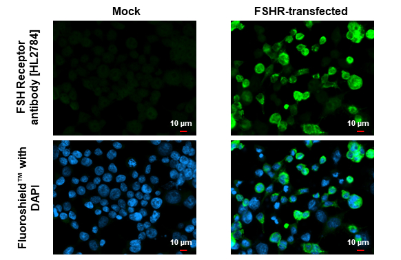 FSH Receptor antibody [HL2784] detects FSH Receptor protein by immunofluorescent analysis. Sample: Mock and transfected 293T cells were fixed in ice-cold MeOH for 5 min. Green: FSH Receptor stained by FSH Receptor antibody [HL2784] (GTX639652) diluted at 1:500. Blue: Fluoroshield with DAPI (GTX30920).