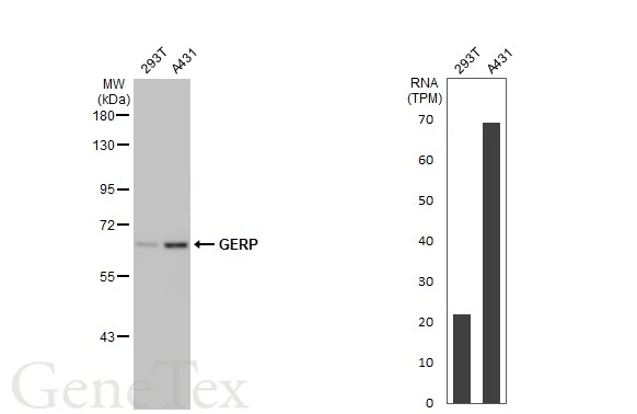 Various whole cell extracts (30 μg) were separated by 7.5% SDS-PAGE, and the membrane was blotted with GERP antibody [HL2797] (GTX639685) diluted at 1:1000. The HRP-conjugated anti-rabbit IgG antibody (GTX213110-01) was used to detect the primary antibody. Corresponding RNA expression data for the same cell lines are based on Human Protein Atlas program.