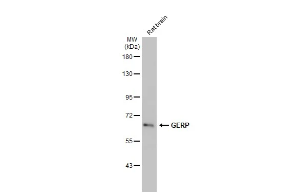 Rat tissue extract (50 μg) was separated by 7.5% SDS-PAGE, and the membrane was blotted with GERP antibody [HL2797] (GTX639685) diluted at 1:1000. The HRP-conjugated anti-rabbit IgG antibody (GTX213110-01) was used to detect the primary antibody, and the signal was developed with Trident ECL plus-Enhanced.