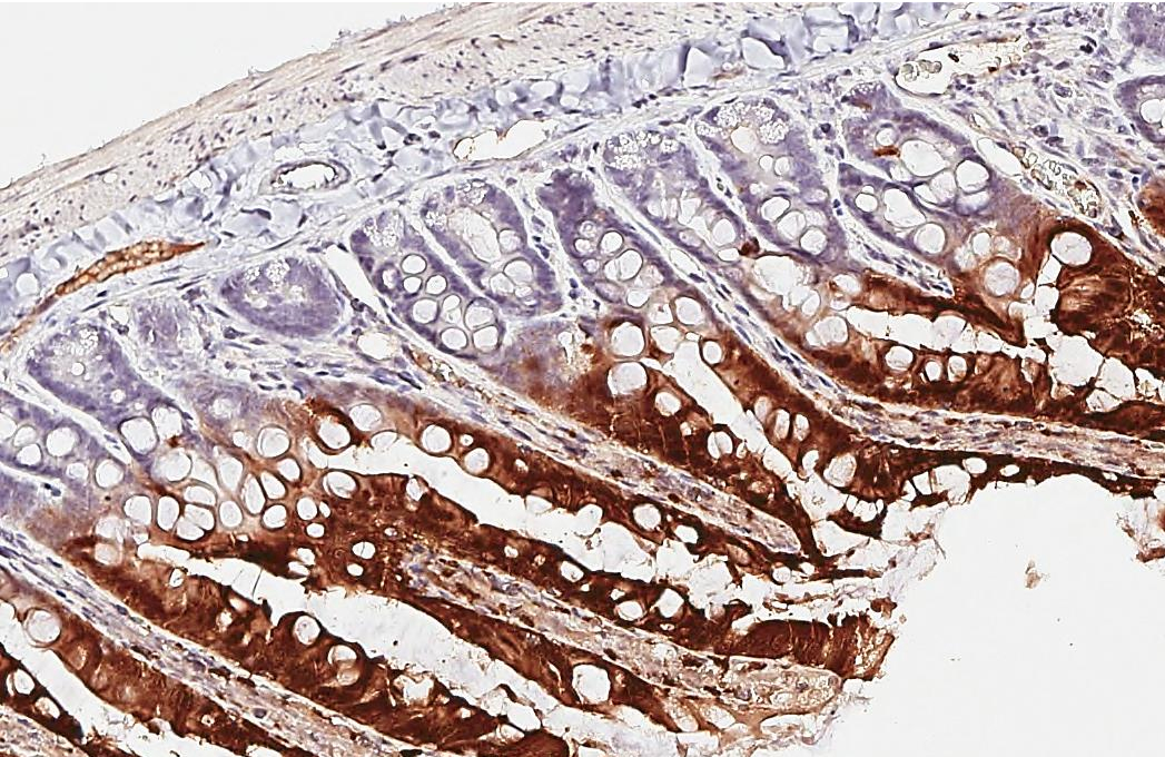 P2Y2 antibody [HL2801] detects P2Y2 protein by immunohistochemical analysis. Sample: Paraffin-embedded rat small intestine. P2Y2 stained by P2Y2 antibody [HL2801] (GTX639689) diluted at 1:200. Antigen Retrieval: Citrate buffer, pH 6.0, 15 min