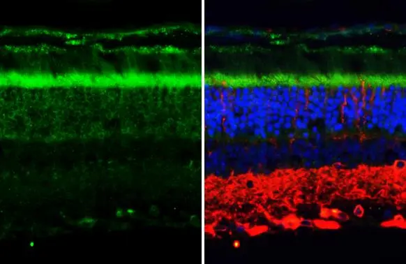 P2Y2 antibody [HL2801] detects P2Y2 protein at cytoplasm by immunohistochemical analysis. Sample: Paraffin-embedded mouse eye. Green: P2Y2 stained by P2Y2 antibody [HL2801] (GTX639689) diluted at 1:200. Red: beta Tubulin 3/ Tuj1, a neural marker, stained by beta Tubulin 3/ Tuj1 antibody [GT11710] (GTX631836) diluted at 1:500. Blue: Fluoroshield with DAPI (GTX30920). Antigen Retrieval: Citrate buffer, pH 6.0, 15 min