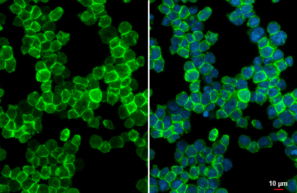 P2Y2 antibody [HL2801]