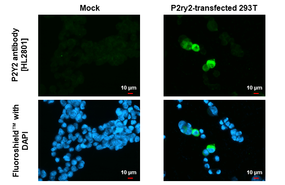P2Y2 antibody [HL2801] detects P2Y2 protein by immunofluorescent analysis. Sample: Mock and transfected 293T cells were fixed in ice-cold MeOH for 5 min. Green: P2Y2 stained by P2Y2 antibody [HL2801] (GTX639689) diluted at 1:500. Blue: Fluoroshield with DAPI (GTX30920).