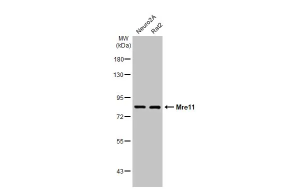 Various whole cell extracts (30 μg) were separated by 7.5% SDS-PAGE, and the membrane was blotted with Mre11 antibody [HL1386-MS] (GTX639690) diluted at 1:1000. The HRP-conjugated anti-mouse IgG antibody (GTX213111-01) was used to detect the primary antibody.