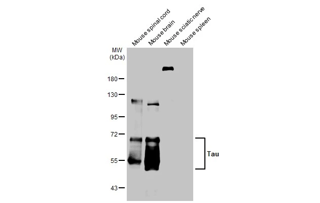 Tau antibody [HL2802]