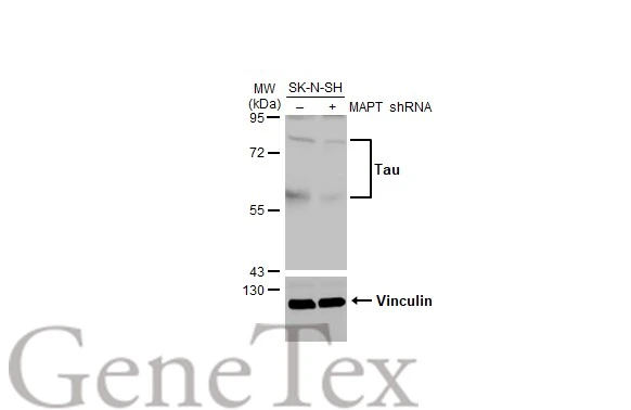 Tau antibody [HL2802]