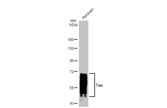 Tau antibody [HL2802]