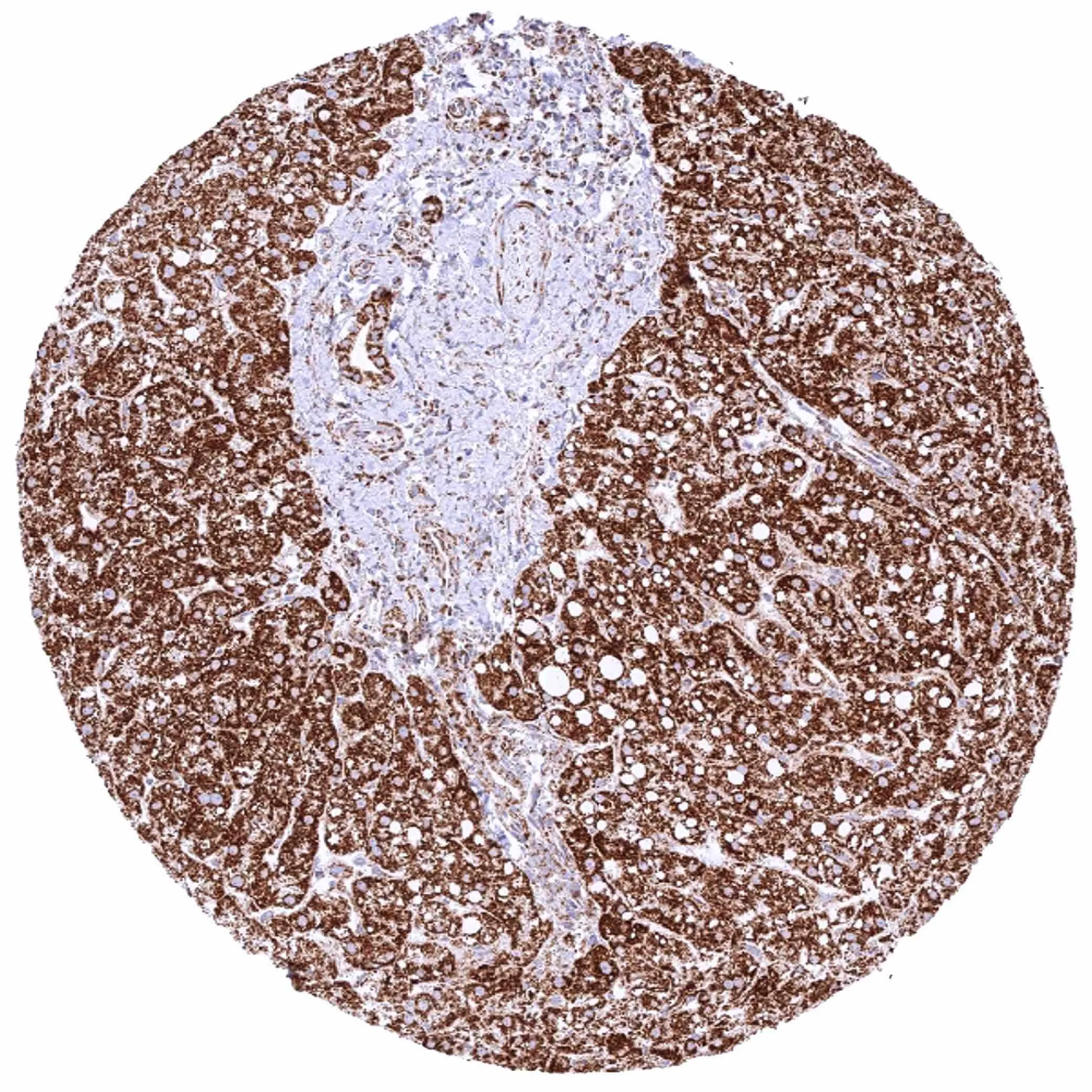 SDHB antibody [HMV320] HistoMAX[TM]