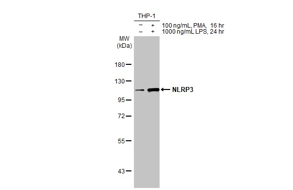 Untreated (–) and treated (+) THP-1 whole cell extracts (30 μg) were separated by 7.5% SDS-PAGE, and the membrane was blotted with NLRP3 antibody [HL2813] (GTX639954) diluted at 1:500. The HRP-conjugated anti-rabbit IgG antibody (GTX213110-01) was used to detect the primary antibody.