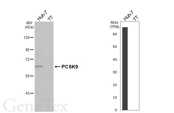 PCSK9 antibody [HL2814]