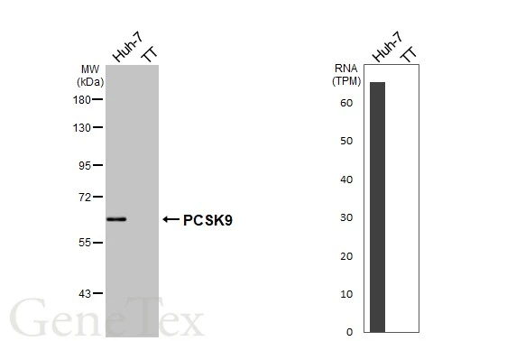 PCSK9 antibody [HL2815]
