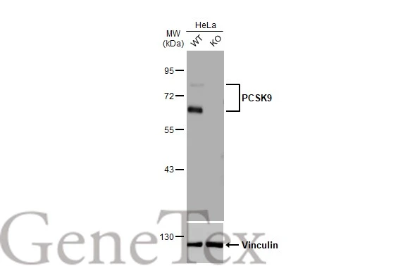 PCSK9 antibody [HL2815]