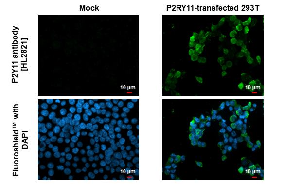 P2Y11 antibody [HL2821] detects P2Y11 protein by immunofluorescent analysis. Sample: Mock and transfected 293T cells were fixed in ice-cold MeOH for 5 min. Green: P2Y11 stained by P2Y11 antibody [HL2821] (GTX640092) diluted at 1:500. Blue: Fluoroshield with DAPI (GTX30920).