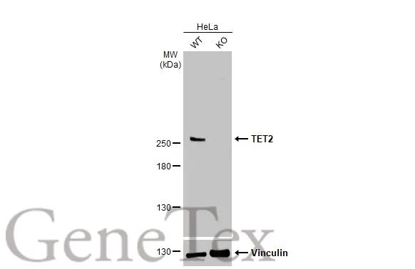 Wild-type (WT) and TET2 knockout (KO) HeLa cell extracts (30 μg) were separated by 5% SDS-PAGE, and the membrane was blotted with TET2 antibody [HL2822] (GTX640093) diluted at 1:1000. The HRP-conjugated anti-rabbit IgG antibody (GTX213110-01) was used to detect the primary antibody, and the signal was developed with Trident ECL plus-Enhanced.