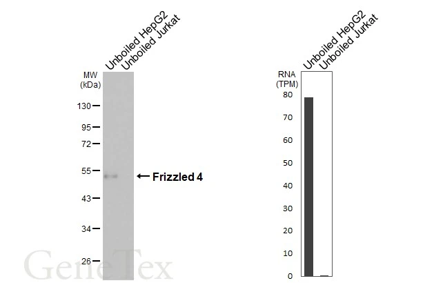 Unboiled various whole cell extracts (30 μg) were separated by 10% SDS-PAGE, and the membrane was blotted with Frizzled 4 antibody [HL2824] (GTX640095) diluted at 1:1000. The HRP-conjugated anti-rabbit IgG antibody (GTX213110-01) was used to detect the primary antibody, and the signal was developed with Trident ECL plus-Enhanced. Corresponding RNA expression data for the same cell lines are based on Human Protein Atlas program.