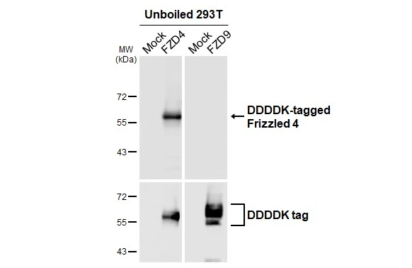 Unboiled non-transfected (–) and transfected (+) 293T whole cell extracts (30 μg) were separated by 10% SDS-PAGE, and the membrane was blotted with Frizzled 4 antibody [HL2824] (GTX640095) diluted at 1:5000. The HRP-conjugated anti-rabbit IgG antibody (GTX213110-01) was used to detect the primary antibody.