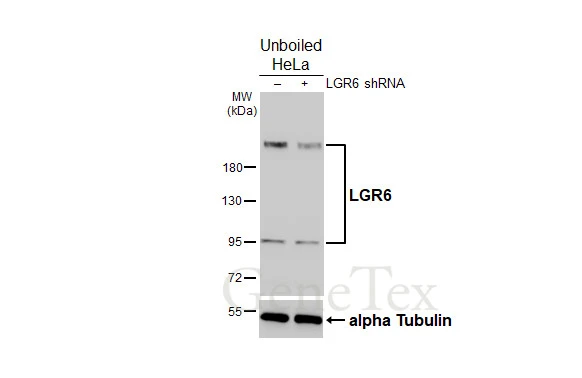 Non-transfected (–) and transfected (+) unboiled HeLa whole cell extracts (30 μg) were separated by 7.5% SDS-PAGE, and the membrane was blotted with LGR6 antibody [HL2827] (GTX640098) diluted at 1:1000. The HRP-conjugated anti-rabbit IgG antibody (GTX213110-01) was used to detect the primary antibody.