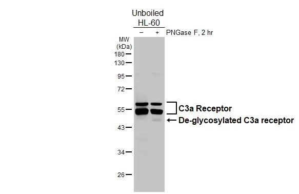 Untreated (–) and treated (+) unboiled HL-60 whole cell extracts (30 μg) were separated by 10% SDS-PAGE, and the membrane was blotted with C3a Receptor antibody [HL2831] (GTX640102) diluted at 1:1000. The HRP-conjugated anti-rabbit IgG antibody (GTX213110-01) was used to detect the primary antibody, and the signal was developed with Trident ECL plus-Enhanced.