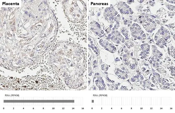 CCR1 antibody [HL2840] detects CCR1 protein by immunohistochemical analysis. Sample: Paraffin-embedded human tissues. CCR1 stained by CCR1 antibody [HL2840] (GTX640111) diluted at 1:100. Antigen Retrieval: Citrate buffer, pH 6.0, 15 min Corresponding RNA expression data for the same tissues are based on NCBI.