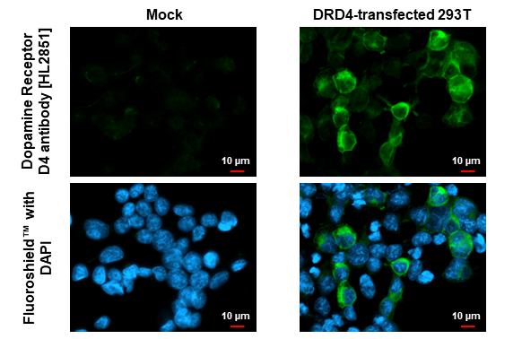 Dopamine Receptor D4 antibody [HL2851] detects Dopamine Receptor D4 protein by immunofluorescent analysis. Sample: Mock and transfected 293T cells were fixed in ice-cold MeOH for 5 min. Green: Dopamine Receptor D4 stained by Dopamine Receptor D4 antibody [HL2851] (GTX640122) diluted at 1:500. Blue: Fluoroshield with DAPI (GTX30920).