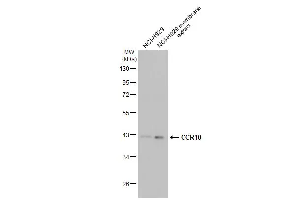 CCR10 antibody [HL2852]