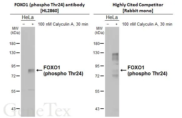 Untreated (–) and treated (+) HeLa whole cell extracts (30 μg) were separated by 7.5% SDS-PAGE, and the membranes were blotted with FOXO1 (phospho Thr24) antibody [HL2860] (GTX640131) diluted at 1:1000 and competitor's antibody (Highly cited competitor) diluted at 1:1000. The HRP-conjugated anti-rabbit IgG antibody (GTX213110-01) was used to detect the primary antibody. *The competitor is not affiliated with GeneTex and does not endorse this product.