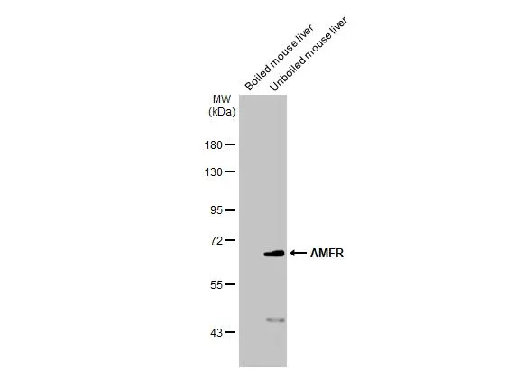 Boiled and unboiled mouse tissue extract (50 μg) were separated by 7.5% SDS-PAGE, and the membrane was blotted with AMFR antibody [HL2865] (GTX640142) diluted at 1:1000. The HRP-conjugated anti-rabbit IgG antibody (GTX213110-01) was used to detect the primary antibody.