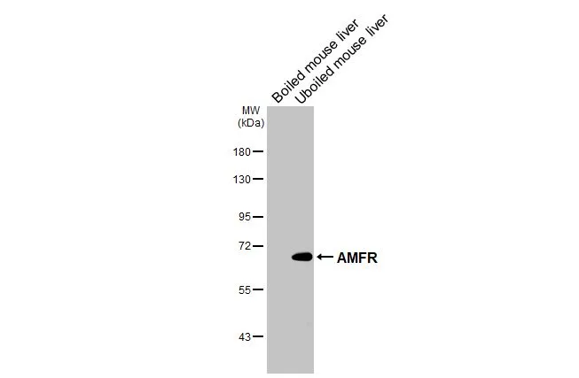 Boiled and unboiled mouse tissue extract (50 μg) were separated by 7.5% SDS-PAGE, and the membrane was blotted with AMFR antibody [HL2866] (GTX640143) diluted at 1:1000. The HRP-conjugated anti-rabbit IgG antibody (GTX213110-01) was used to detect the primary antibody.
