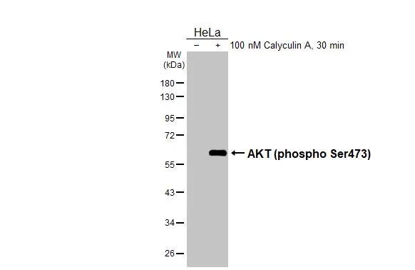 Untreated (–) and treated (+) HeLa whole cell extracts (30 μg) were separated by 10% SDS-PAGE, and the membrane was blotted with AKT (phospho Ser473) antibody [HL2871] (GTX640148) diluted at 1:1000. The HRP-conjugated anti-rabbit IgG antibody (GTX213110-01) was used to detect the primary antibody.