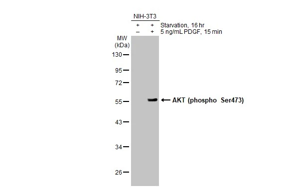Untreated (–) and treated (+) NIH-3T3 whole cell extracts (30 μg) were separated by 10% SDS-PAGE, and the membrane was blotted with AKT (phospho Ser473) antibody [HL2871] (GTX640148) diluted at 1:1000. The HRP-conjugated anti-rabbit IgG antibody (GTX213110-01) was used to detect the primary antibody.