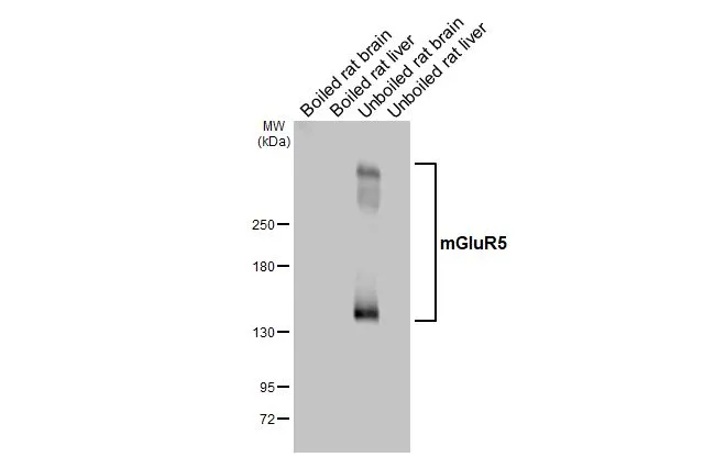 Boiled and unboiled various tissue extracts (50 μg) were separated by 5% SDS-PAGE, and the membrane was blotted with mGluR5 antibody [HL2876] (GTX640153) diluted at 1:1000. The HRP-conjugated anti-rabbit IgG antibody (GTX213110-01) was used to detect the primary antibody, and the signal was developed with Trident ECL plus-Enhanced.