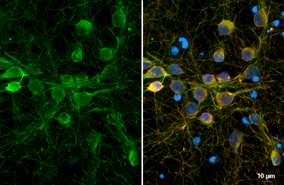 mGluR5 antibody [HL2876] detects mGluR5 protein by immunofluorescent analysis. Sample: DIV11 rat E18 hippocampal neurons and glial cells were fixed in 4% paraformaldehyde at RT for 15 min. Green: mGluR5 stained by mGluR5 antibody [HL2876] (GTX640153) diluted at 1:250. Red: Tau, an axon marker, stained by Tau antibody [GT287] (GTX634809) diluted at 1:500. Blue: Fluoroshield with DAPI (GTX30920).
