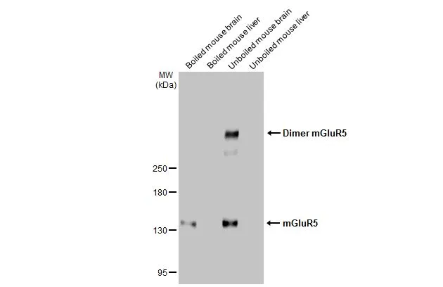 Various tissue extracts (50 μg) were separated by 5% SDS-PAGE, and the membrane was blotted with mGluR5 antibody [HL2876] (GTX640153) diluted at 1:1000. The HRP-conjugated anti-rabbit IgG antibody (GTX213110-01) was used to detect the primary antibody, and the signal was developed with Trident ECL plus-Enhanced.