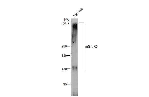 Rat tissue extract (50 μg) was separated by 5% SDS-PAGE, and the membrane was blotted with mGluR5 antibody [HL2877] (GTX640153) diluted at 1:1000. The HRP-conjugated anti-rabbit IgG antibody (GTX213110-01) was used to detect the primary antibody, and the signal was developed with Trident ECL plus-Enhanced.