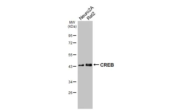 Various whole cell extracts (30 μg) were separated by 10% SDS-PAGE, and the membrane was blotted with CREB antibody [HL2879] (GTX640158) diluted at 1:1000. The HRP-conjugated anti-rabbit IgG antibody (GTX213110-01) was used to detect the primary antibody, and the signal was developed with Trident femto Western HRP Substrate.