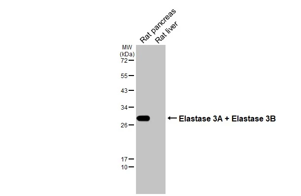 Various tissue extracts (50 μg) were separated by 12% SDS-PAGE, and the membrane was blotted with Elastase 3A + Elastase 3B antibody [HL2882] (GTX640161) diluted at 1:1000. The HRP-conjugated anti-rabbit IgG antibody (GTX213110-01) was used to detect the primary antibody.