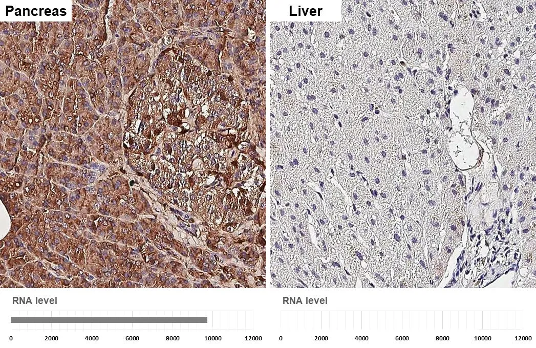 Elastase 3A + Elastase 3B antibody [HL2882] detects Elastase 3A + Elastase 3B protein by immunohistochemical analysis. Sample: Paraffin-embedded human tissues. Elastase 3A + Elastase 3B stained by Elastase 3A + Elastase 3B antibody [HL2882] (GTX640161) diluted at 1:200. Antigen Retrieval: Citrate buffer, pH 6.0, 15 min