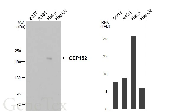 Various whole cell extracts (30 μg) were separated by 5% SDS-PAGE, and the membrane was blotted with CEP152 antibody [HL2884] (GTX640163) diluted at 1:1000. The HRP-conjugated anti-rabbit IgG antibody (GTX213110-01) was used to detect the primary antibody, and the signal was developed with Trident ECL plus-Enhanced. Corresponding RNA expression data for the same cell lines are based on Human Protein Atlas program.