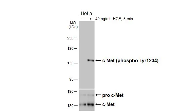 Untreated (–) and treated (+) HeLa whole cell extracts (30 μg) were separated by 5% SDS-PAGE, and the membrane was blotted with c-Met (phospho Tyr1234) antibody [HL2907] (GTX640244) diluted at 1:1000. The HRP-conjugated anti-rabbit IgG antibody (GTX213110-01) was used to detect the primary antibody, and the signal was developed with Trident ECL plus-Enhanced.