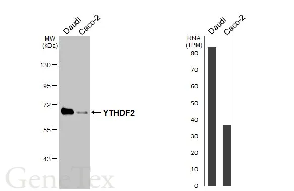 YTHDF2 antibody [HL2910]