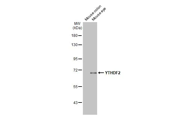 YTHDF2 antibody [HL2910]