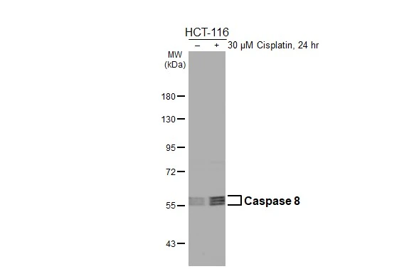 Untreated (–) and treated (+) HCT-116 whole cell extract (30 μg) were separated by 7.5% SDS-PAGE, and the membrane was blotted with Caspase 8 antibody [HL2914] (GTX640257) diluted at 1:500. The HRP-conjugated anti-rabbit IgG antibody (GTX213110-01) was used to detect the primary antibody.