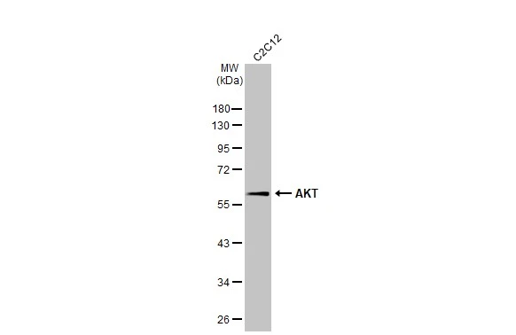 AKT antibody [HL2915]