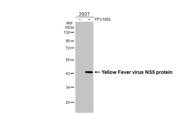 Non-transfected (–) and transfected (+) 293T whole cell extracts (30 μg) were separated by 10% SDS-PAGE, and the membrane was blotted with Yellow Fever virus NS5 protein antibody [HL2916] (GTX640259) diluted at 1:5000. The HRP-conjugated anti-rabbit IgG antibody (GTX213110-01) was used to detect the primary antibody.