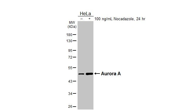 Aurora A antibody [HL2917]