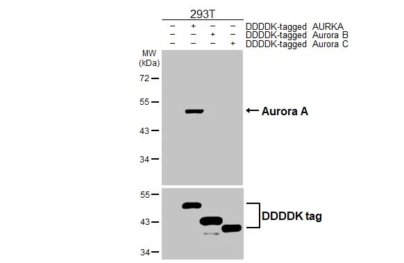 Aurora A antibody [HL2917]