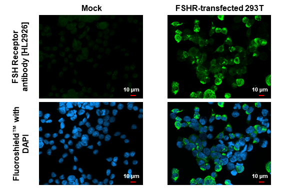 FSH Receptor antibody [HL2926] detects FSH Receptor protein by immunofluorescent analysis. Sample: Mock and transfected 293T cells were fixed in ice-cold MeOH for 5 min. Green: FSH Receptor stained by FSH Receptor antibody [HL2926] (GTX640269) diluted at 1:500. Blue: Fluoroshield with DAPI (GTX30920).