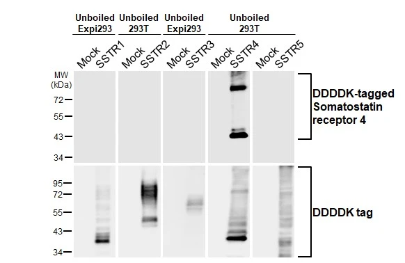 Unboiled non-transfected (–) and transfected (+) 293T and Expi293 whole cell extracts (30 μg) were separated by 10% SDS-PAGE, and the membrane was blotted with Somatostatin receptor 4 antibody [HL2933] (GTX640276) diluted at 1:5000. The HRP-conjugated anti-rabbit IgG antibody (GTX213110-01) was used to detect the primary antibody.