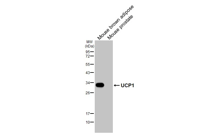 Various tissue extracts (50 μg) were separated by 12% SDS-PAGE, and the membrane was blotted with UCP1 antibody [HL2944] (GTX640329) diluted at 1:1000. The HRP-conjugated anti-rabbit IgG antibody (GTX213110-01) was used to detect the primary antibody.